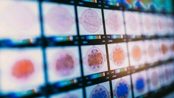A wall of screens showing brain-scan heat maps in sequence